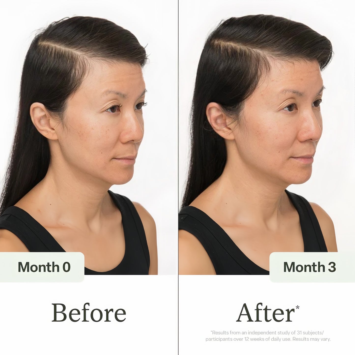 Divi Scalp Serum for Thinning Hair Clinically Tested, Non-Greasy Formula with Amino Acids, Caffeine & Rosemary Oil Promotes Healthy Scalp & Fuller-Looking Hair, Reduces Oil & Product Buildup